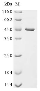 Recombinant Enterobacteria phage T4 RNA ligase 2 (Y10A)