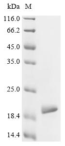 Recombinant Human Microtubule-associated protein tau (MAPT), partial