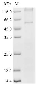 Recombinant Human Frizzled-2 (FZD2)