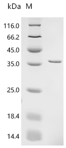 Recombinant Mycobacterium tuberculosis Protein grpE (grpE)
