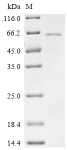 Recombinant Human Protein mono-ADP-ribosyltransferase PARP10 (PARP10), partial