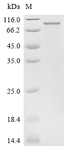 Recombinant Human Poly [ADP-ribose] polymerase 6 (PARP6)