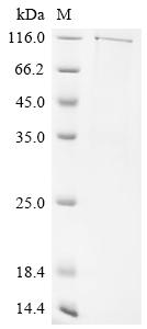 Recombinant Human Protein mono-ADP-ribosyltransferase PARP8 (PARP8)