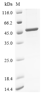 Recombinant Human Protein mono-ADP-ribosyltransferase PARP10 (PARP10), partial