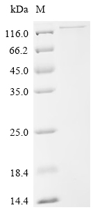 Recombinant Human Protein mono-ADP-ribosyltransferase PARP8 (PARP8)