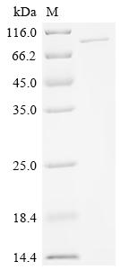 Recombinant Human Poly [ADP-ribose] polymerase 6 (PARP6)