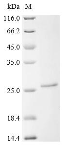 Recombinant Mouse Cytochrome c oxidase subunit 2 (Mtco2), partial