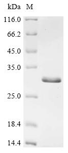 Recombinant Human Charged multivesicular body protein 2b (CHMP2B)