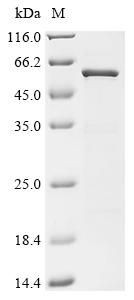 Recombinant Bat coronavirus HKU4 Nucleoprotein (N)