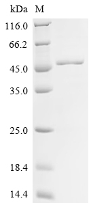 Recombinant Human Poly [ADP-ribose] polymerase 1 (PARP11), partial