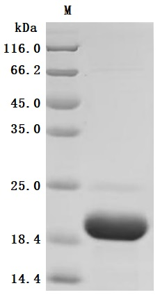 Recombinant Human Kidney-associated antigen 1(KAAG1) (Active)
