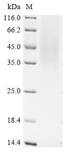 Recombinant Simian retrovirus SRV-1 Envelope glycoprotein (env), partial