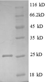 Recombinant Human Tumor necrosis factor receptor superfamily member 3 (LTBR), partial