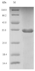 Recombinant Human Fibroblast growth factor 10 (FGF10), partial