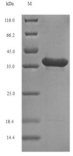 Recombinant Human Fibroblast growth factor 10 (FGF10), partial