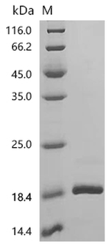 Recombinant Rat Tumor necrosis factor (Tnf), partial (Active)