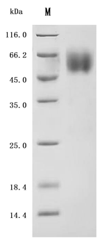 Recombinant Human CD79A&CD79B Heterodimer Protein (Active)