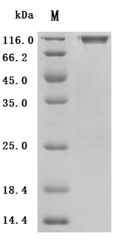 Recombinant Human Proto-oncogene tyrosine-protein kinase receptor Ret (RET), partial (Active)