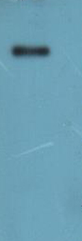 Recombinant Human Leucine-rich repeat-containing G-protein coupled receptor 5 (LGR5)-VLPs (Active)