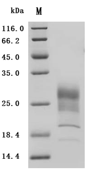 Recombinant Macaca mulatta Interferon gamma (IFNG) (Active)