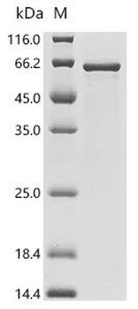Recombinant Human Non-receptor tyrosine-protein kinase TYK2 (TYK2), partial