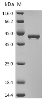 Recombinant Human Fatty acid synthase (FASN), partial