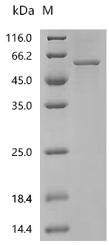 Recombinant Human Cytochrome P450 11B2, mitochondrial (CYP11B2)