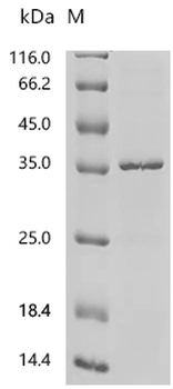 Recombinant Human Cytochrome c1, heme protein, mitochondrial (CYC1)