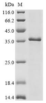 Recombinant Human Cytochrome c1,heme protein, mitochondrial (CYC1)
