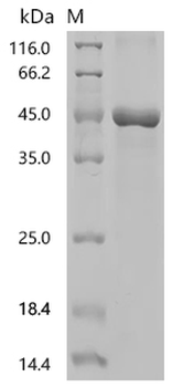 Recombinant Simian retrovirus SRV-2 Envelope glycoprotein (env), partial