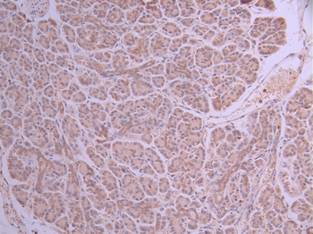 ST13 Antibody