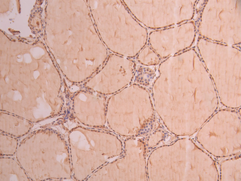 FKBP4 Antibody
