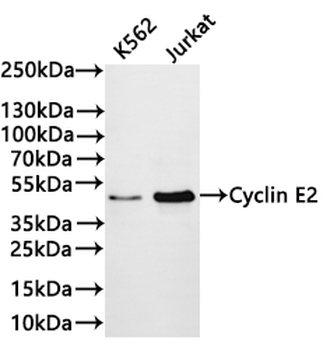 CCNE2 Antibody