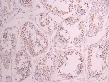 CCNE2 Antibody
