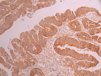 HSPA14 Antibody