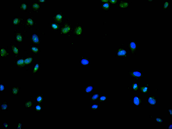 UBA1 Antibody