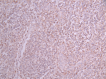 EIF2AK4 Antibody