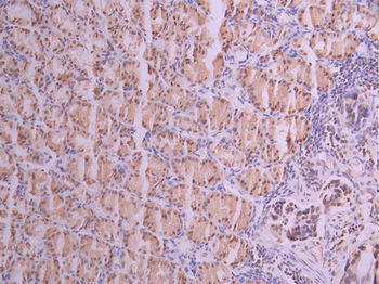 NR2F1 Antibody