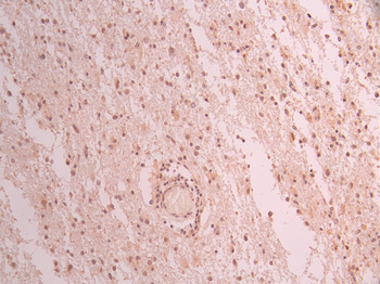 UBA2 Antibody