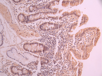 UBA2 Antibody