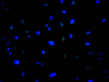 UBA2 Antibody