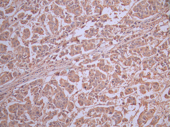IGF1R Antibody