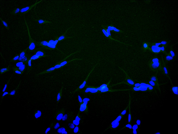 IGF1R Antibody