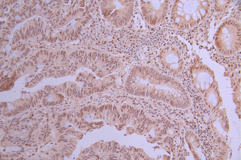 FKBP5 Antibody