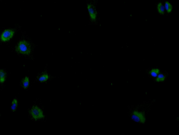 PRKN Antibody