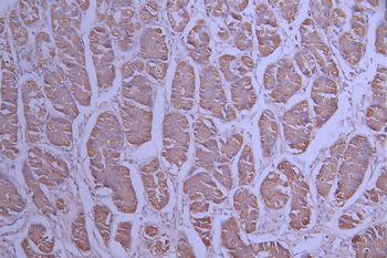 LDHA Antibody