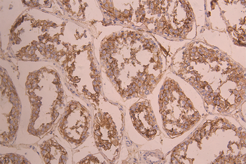 ACE2 Antibody