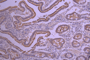ACE2 Antibody