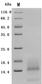 Recombinant Human Tumor necrosis factor receptor superfamily member 17 (TNFRSF17), partial (Active)