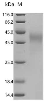 Recombinant Macaca fascicularis Ig-like domain-containing protein (EGM_15593), partial (Active)
